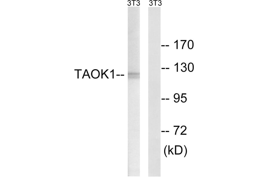 Western Blot - Anti-TAOK1 Antibody (C18619) - Antibodies.com