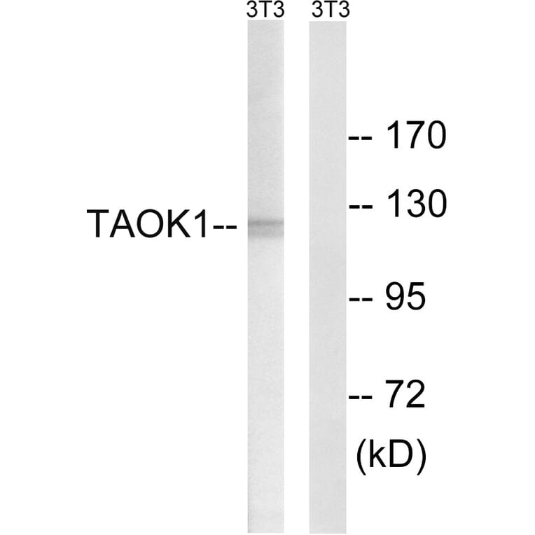 Western Blot - Anti-TAOK1 Antibody (C18619) - Antibodies.com