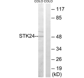 Western Blot - Anti-STK24 Antibody (C18534) - Antibodies.com