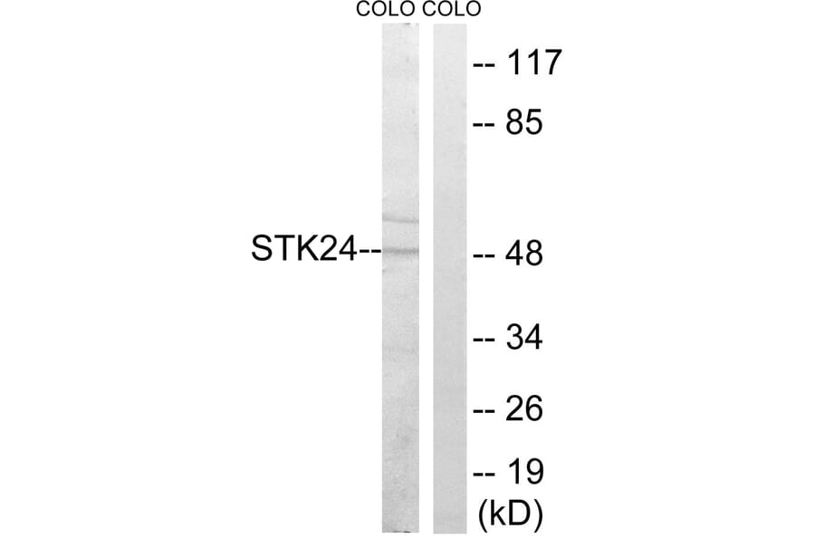 Western Blot - Anti-STK24 Antibody (C18534) - Antibodies.com