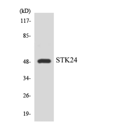 Western Blot - Anti-STK24 Antibody (R12-3569) - Antibodies.com