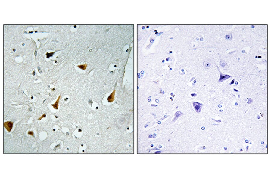 Immunohistochemistry - Anti-STAT6 Antibody (B7229) - Antibodies.com