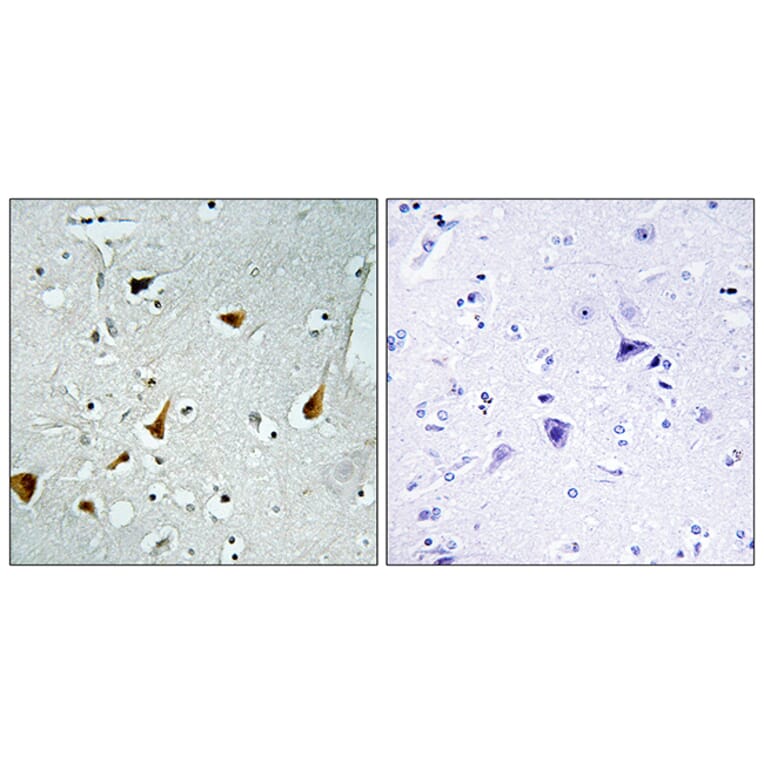 Immunohistochemistry - Anti-STAT6 Antibody (B7229) - Antibodies.com