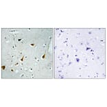 Immunohistochemistry - Anti-STAT6 Antibody (B7229) - Antibodies.com