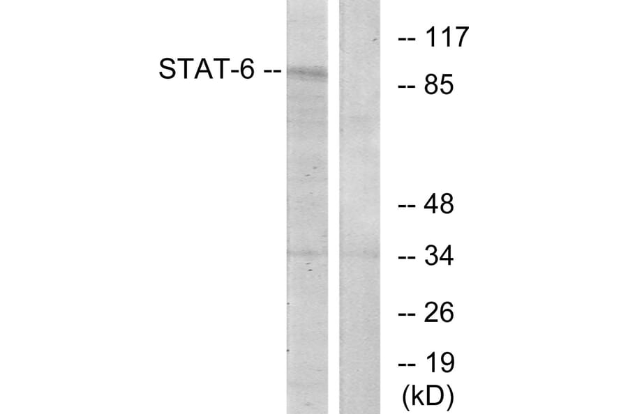 Western Blot - Anti-STAT6 Antibody (B7229) - Antibodies.com