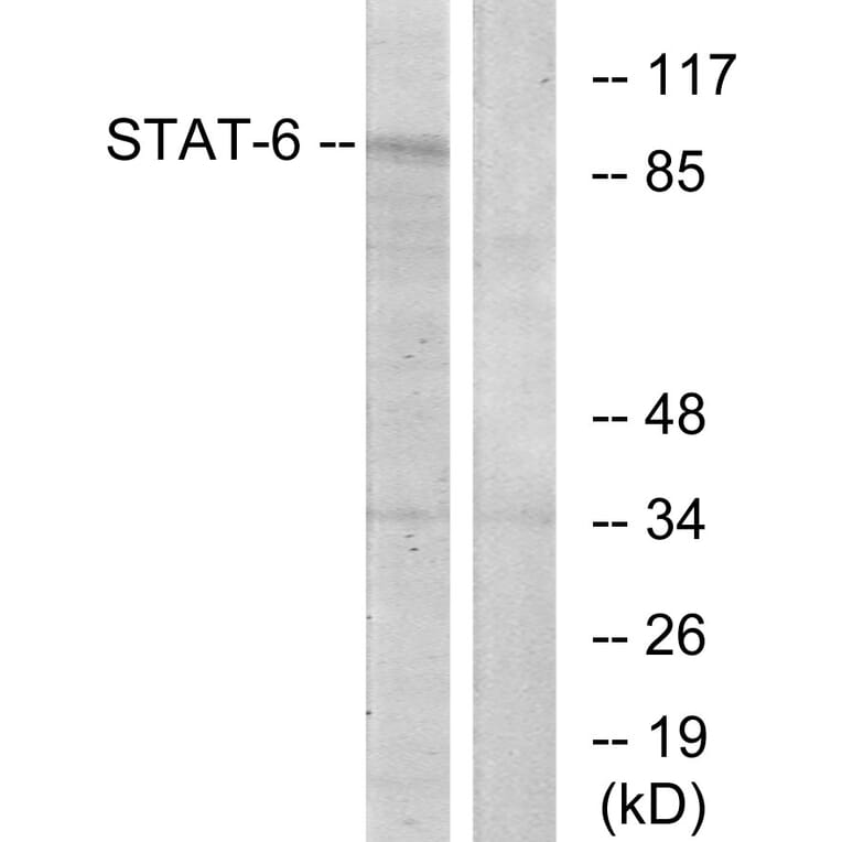 Western Blot - Anti-STAT6 Antibody (B7229) - Antibodies.com