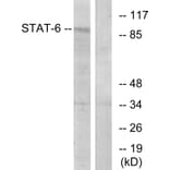 Western Blot - Anti-STAT6 Antibody (B7229) - Antibodies.com