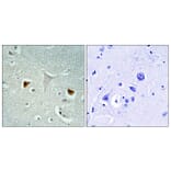 Immunohistochemistry - Anti-STAT3 Antibody (B7223) - Antibodies.com