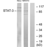 Western Blot - Anti-STAT3 Antibody (B7224) - Antibodies.com