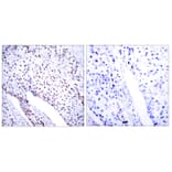 Immunohistochemistry - Anti-STAT3 Antibody (B7224) - Antibodies.com