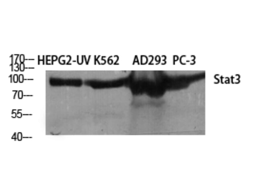 Western Blot - Anti-STAT3 Antibody (B7224) - Antibodies.com