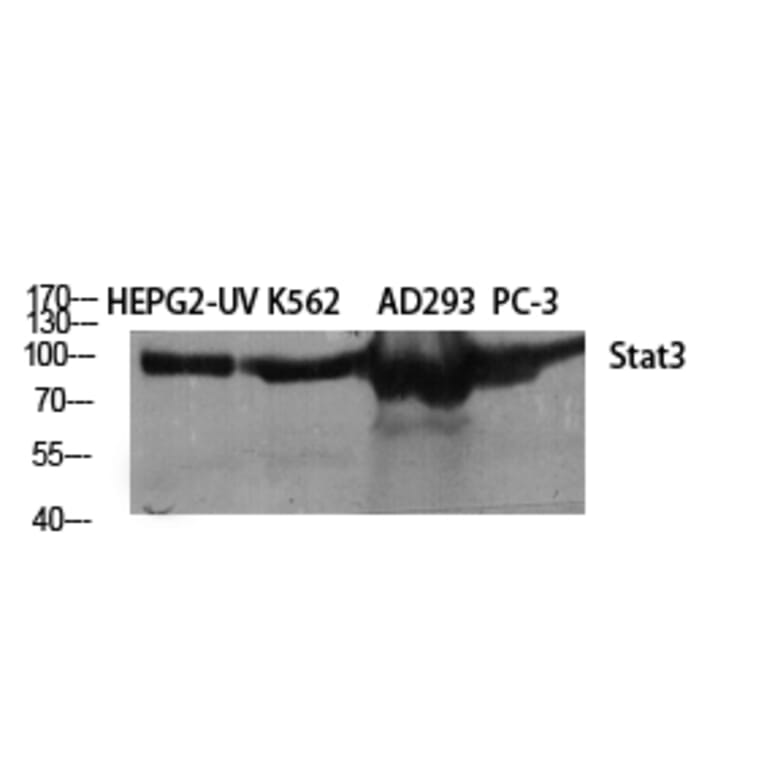 Western Blot - Anti-STAT3 Antibody (B7224) - Antibodies.com
