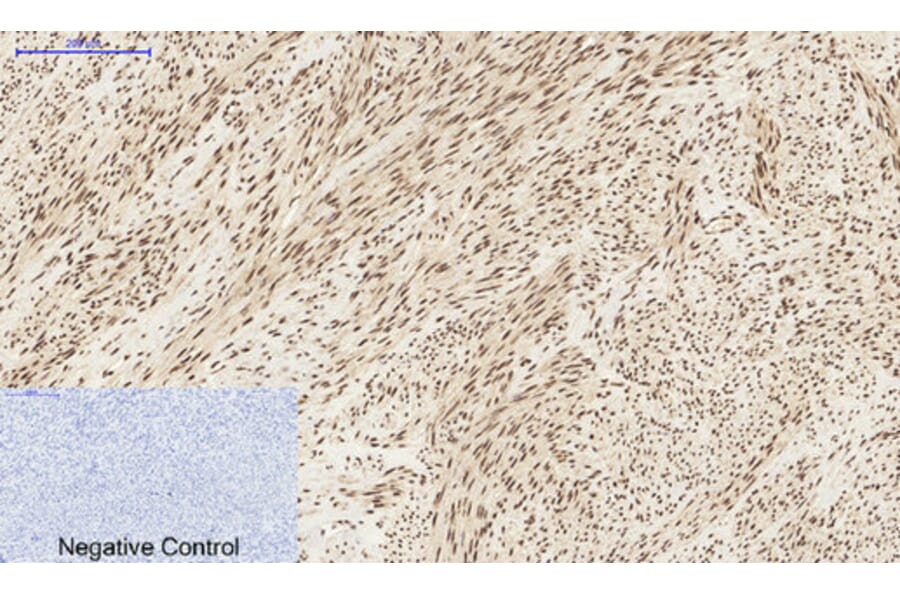Immunohistochemistry - Anti-STAT3 Antibody (B7224) - Antibodies.com