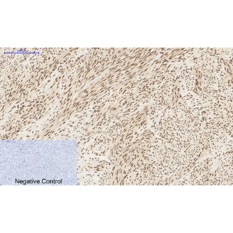 Immunohistochemistry - Anti-STAT3 Antibody (B7224) - Antibodies.com