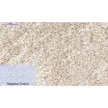 Immunohistochemistry - Anti-STAT3 Antibody (B7224) - Antibodies.com