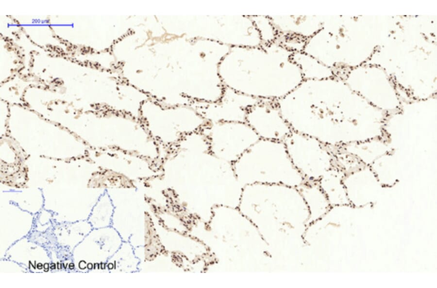 Immunohistochemistry - Anti-STAT3 Antibody (B7224) - Antibodies.com