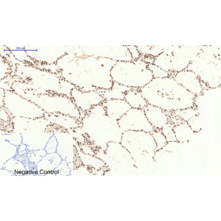 Immunohistochemistry - Anti-STAT3 Antibody (B7224) - Antibodies.com