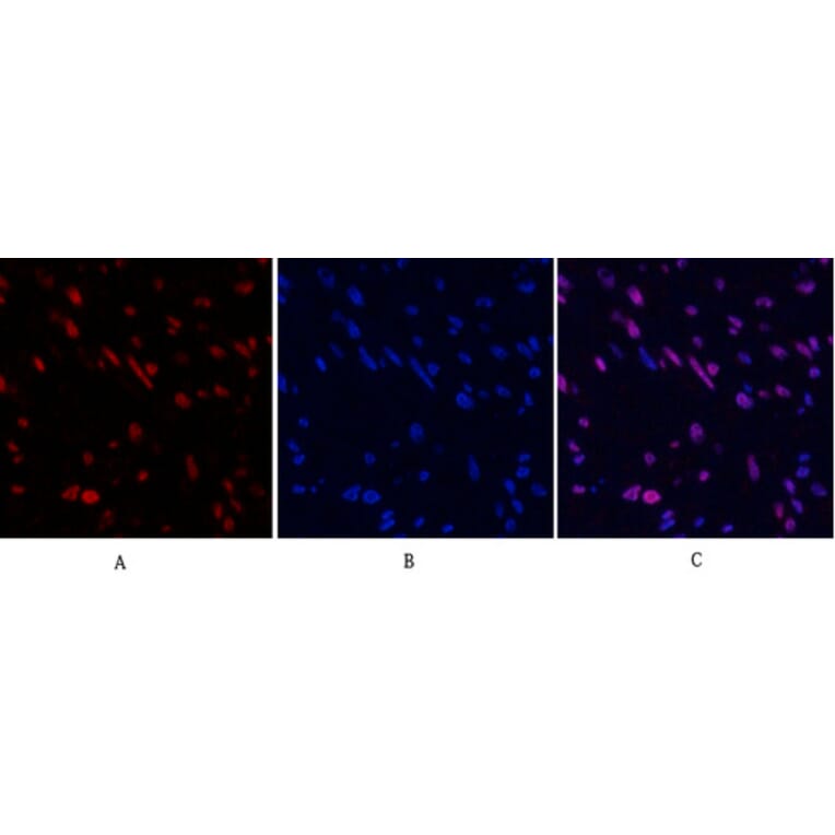 Immunofluorescence - Anti-STAT3 Antibody (B7224) - Antibodies.com