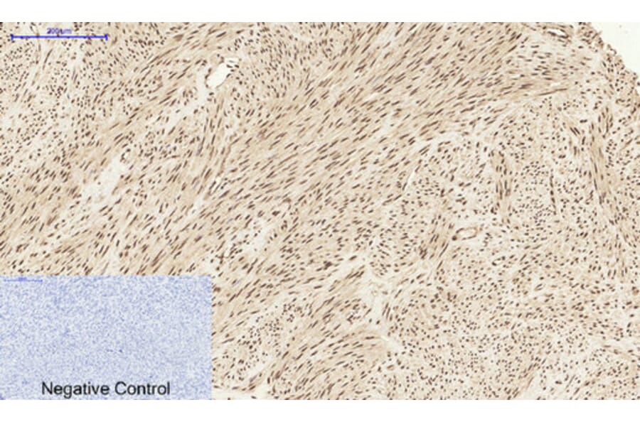 Immunohistochemistry - Anti-STAT1 Antibody (B7221) - Antibodies.com