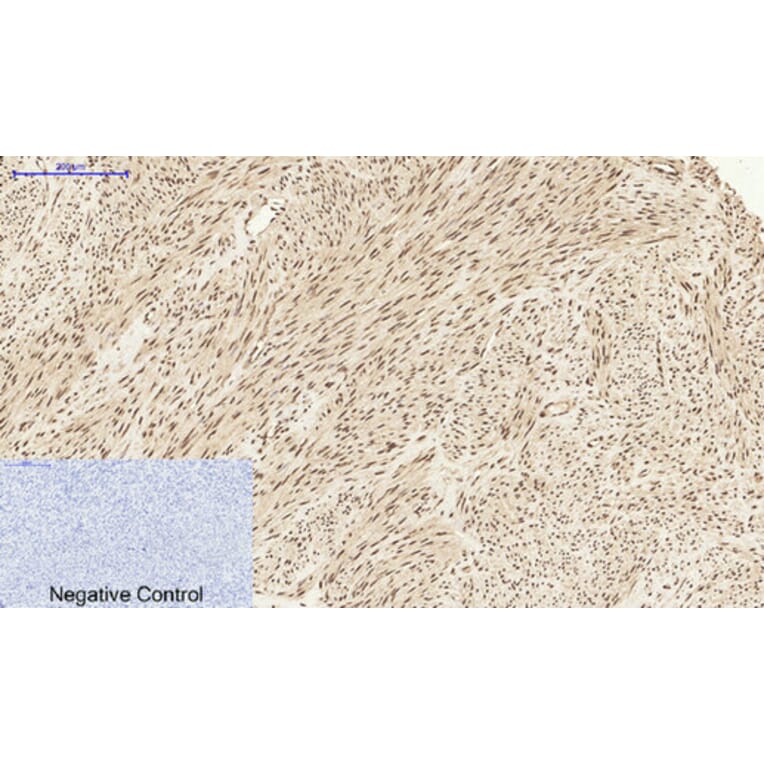 Immunohistochemistry - Anti-STAT1 Antibody (B7221) - Antibodies.com