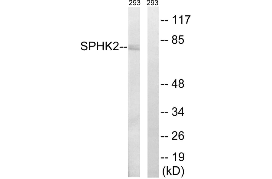 Western Blot - Anti-SPHK2 Antibody (B8423) - Antibodies.com