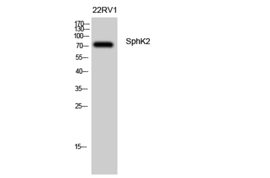 Western Blot - Anti-SPHK2 Antibody (B8423) - Antibodies.com