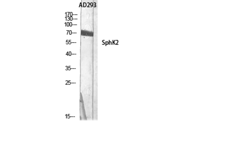 Western Blot - Anti-SPHK2 Antibody (B8423) - Antibodies.com
