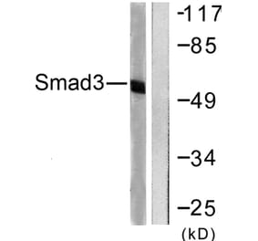 Western Blot - Anti-Smad3 Antibody (B0031) - Antibodies.com