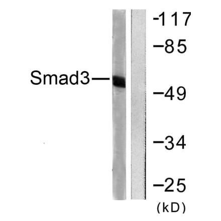 Western Blot - Anti-Smad3 Antibody (B0031) - Antibodies.com