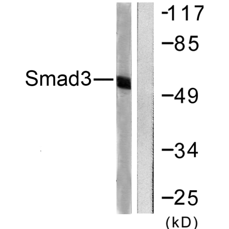 Western Blot - Anti-Smad3 Antibody (B0031) - Antibodies.com