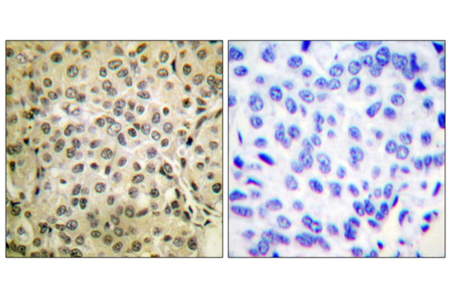 Immunohistochemistry - Anti-Smad3 Antibody (B0031) - Antibodies.com