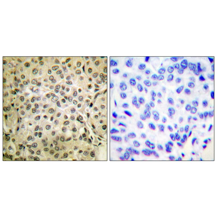 Immunohistochemistry - Anti-Smad3 Antibody (B0031) - Antibodies.com