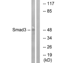 Western Blot - Anti-Smad3 Antibody (B1004) - Antibodies.com