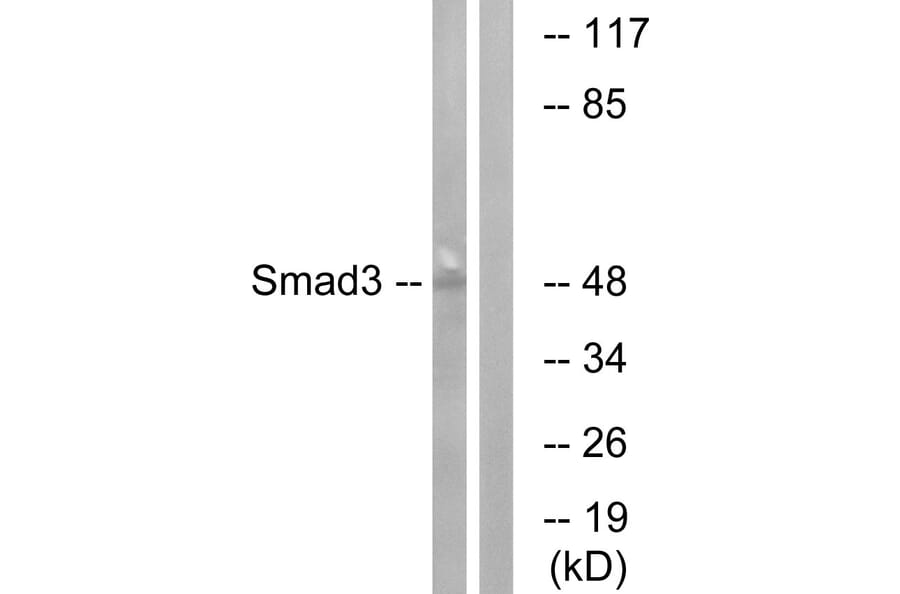 Western Blot - Anti-Smad3 Antibody (B1004) - Antibodies.com