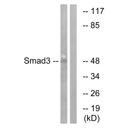 Western Blot - Anti-Smad3 Antibody (B1004) - Antibodies.com