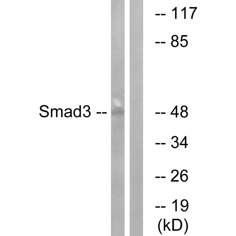 Western Blot - Anti-Smad3 Antibody (B1004) - Antibodies.com