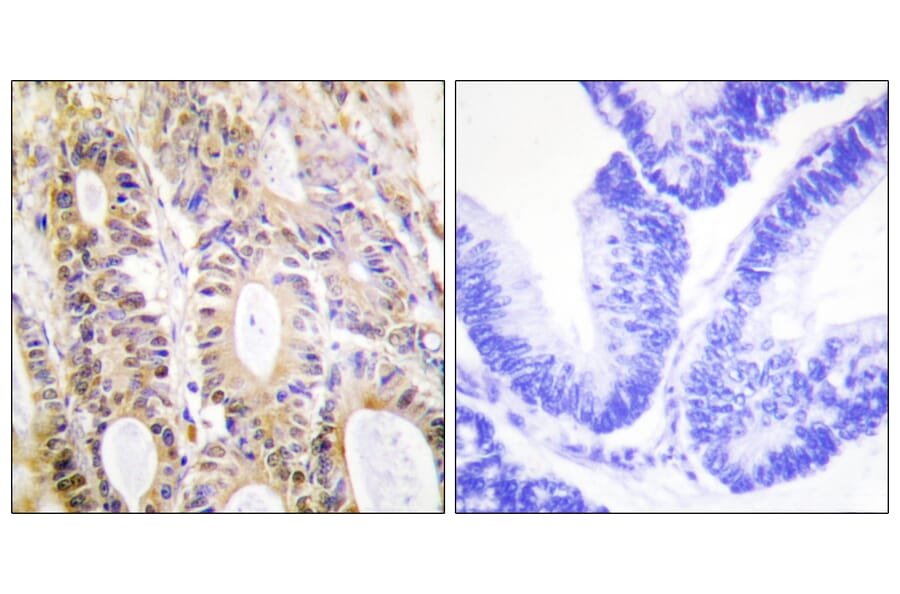 Immunohistochemistry - Anti-Smad3 Antibody (B1004) - Antibodies.com