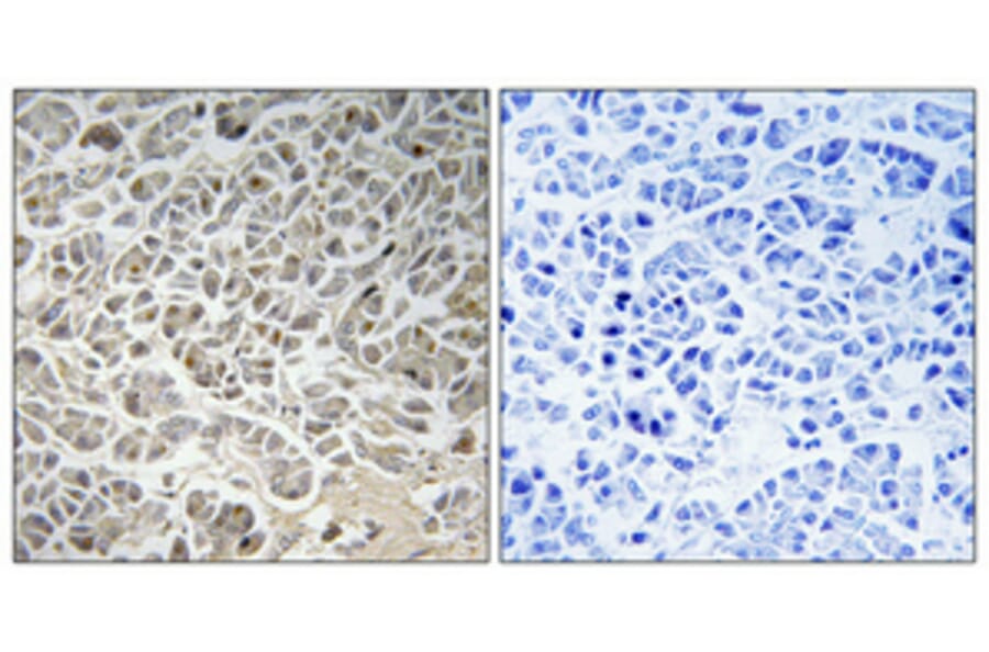 Immunohistochemistry - Anti-Smad3 Antibody (B1004) - Antibodies.com