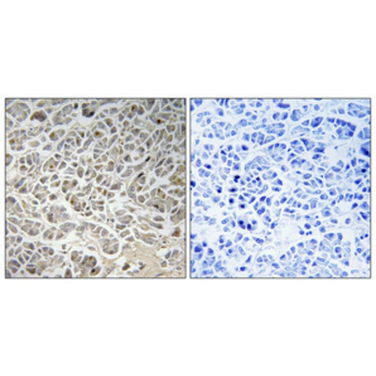 Immunohistochemistry - Anti-Smad3 Antibody (B1004) - Antibodies.com