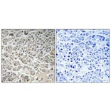 Immunohistochemistry - Anti-Smad3 Antibody (B1004) - Antibodies.com