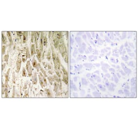 Immunohistochemistry - Anti-Smad1 Antibody (B0029) - Antibodies.com