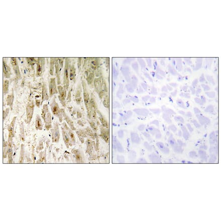 Immunohistochemistry - Anti-Smad1 Antibody (B0029) - Antibodies.com