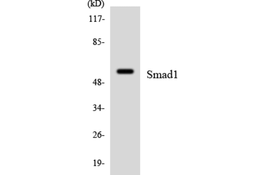 Western Blot - Anti-Smad1 Antibody (R12-3544) - Antibodies.com