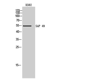 Western Blot - Anti-SF3B4 Antibody (C18922) - Antibodies.com