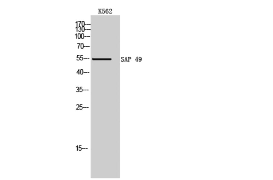 Western Blot - Anti-SF3B4 Antibody (C18922) - Antibodies.com