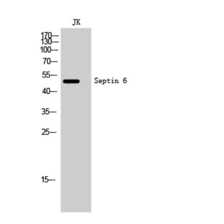 Western Blot - Anti-SEPT6 Antibody (C18512) - Antibodies.com