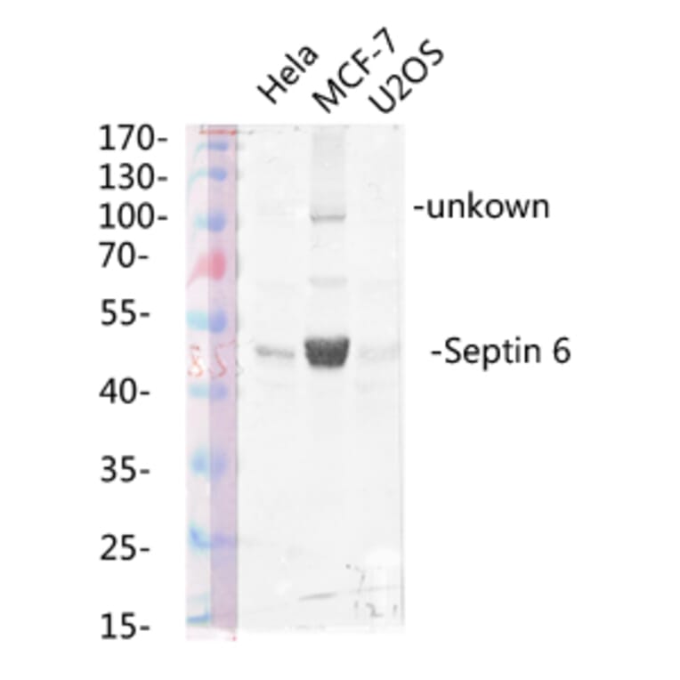 Western Blot - Anti-SEPT6 Antibody (C18512) - Antibodies.com