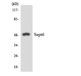 Western Blot - Anti-SEPT6 Antibody (R12-3490) - Antibodies.com