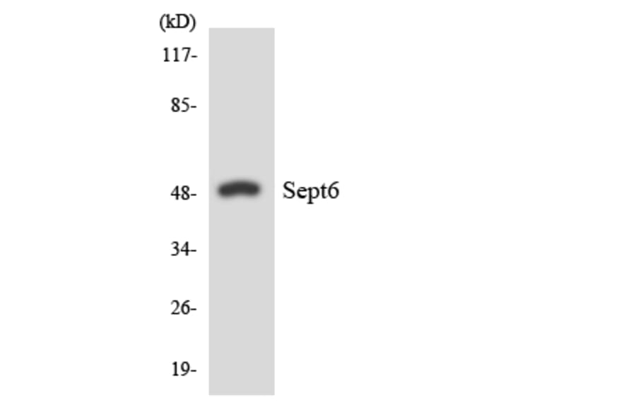 Western Blot - Anti-SEPT6 Antibody (R12-3490) - Antibodies.com