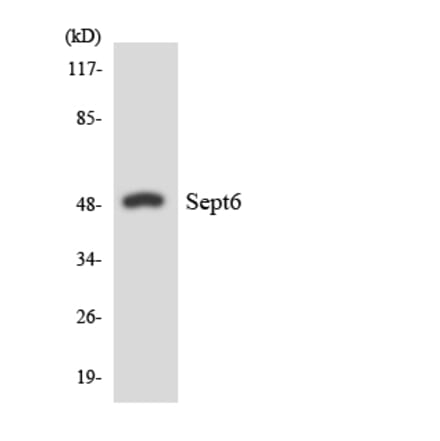 Western Blot - Anti-SEPT6 Antibody (R12-3490) - Antibodies.com